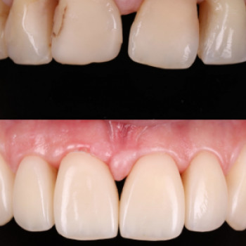 Symfonia, Калуш Фото - 5