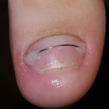 Оксана Брузив, Калуш Фото - 5