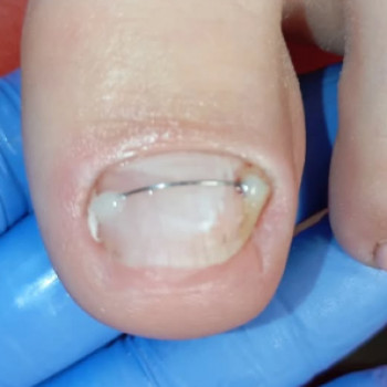 Оксана Брузив, Калуш Фото - 7