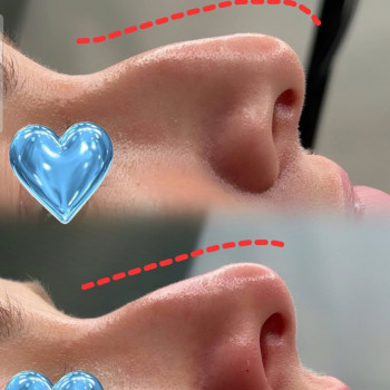 Любовь Боровик, Житомир Фото - 5