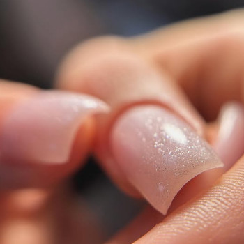 Анна Дрюк, Калуш Фото - 5