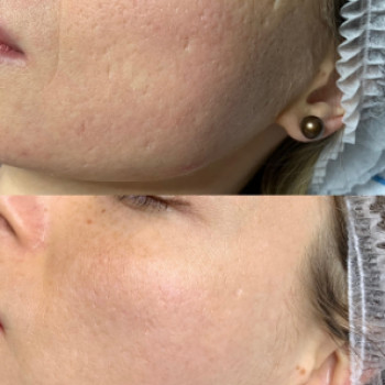 LBeauty, Умань Фото - 5