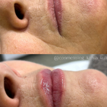 Катя Кулинич, Умань Фото - 5