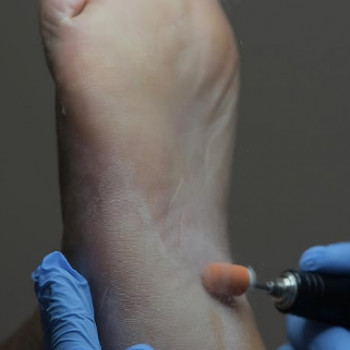 Подо-студия Васкан Леси, Коломыя Фото - 5