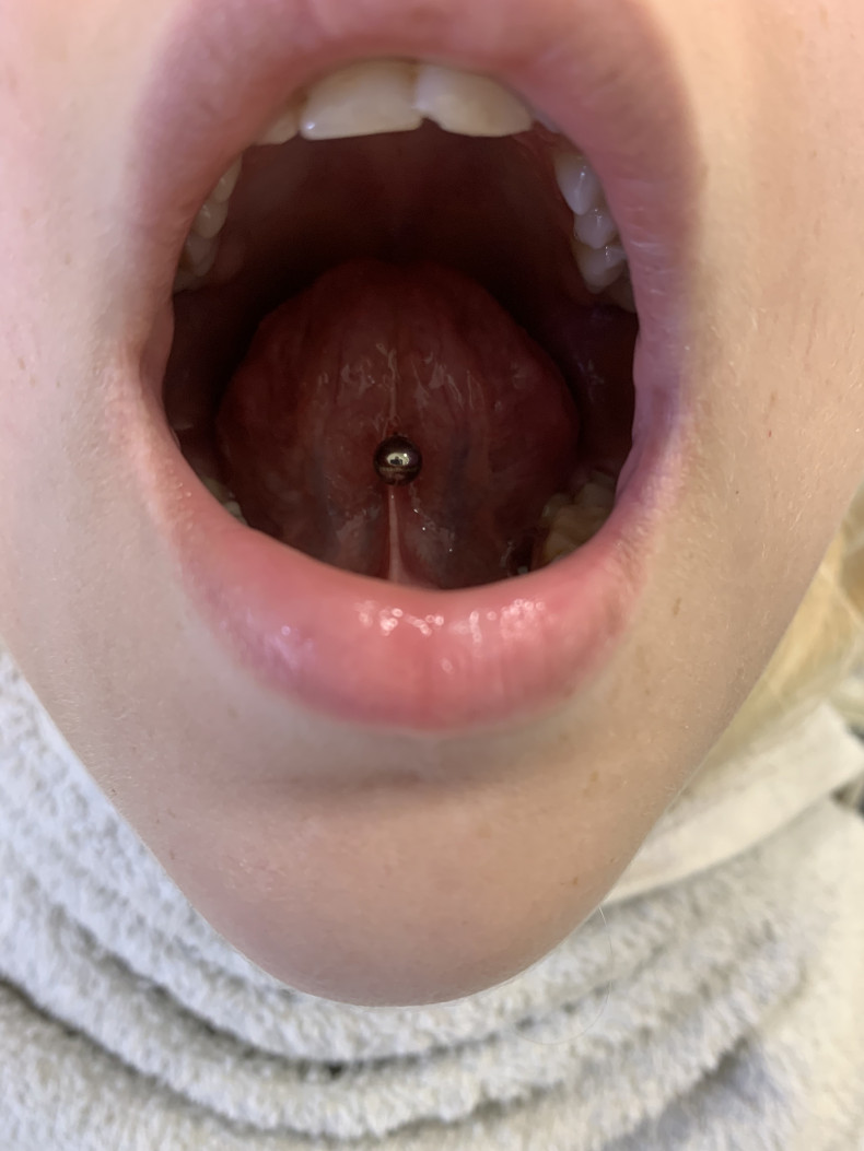 Пірсинг язика
 #пірсингязика, фото - Мастер по пирсингу Татьяна Ананьева