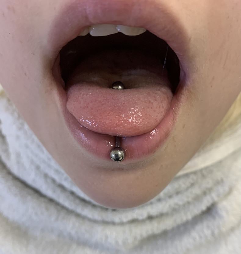 Пірсинг язика, фото - Мастер по пирсингу Татьяна Ананьева