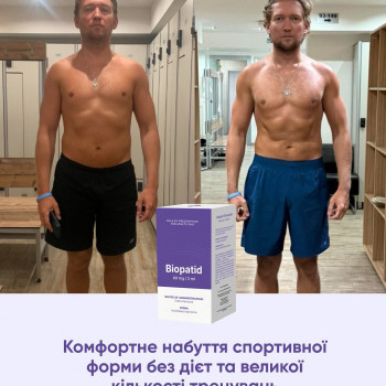 Biopatid зменшення ваги
                    Салон красоты Atmosfera Krasu Черновцы