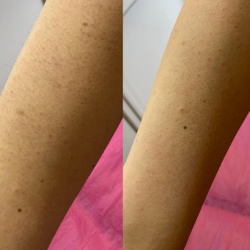 Depil Room, Луцк Фото - 5