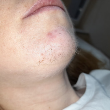 Зона обличчя