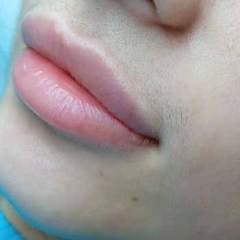 Зона обличчя