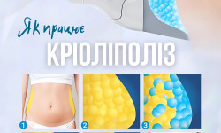 Криолиполиз Косметологический центр Med Laser Одесса