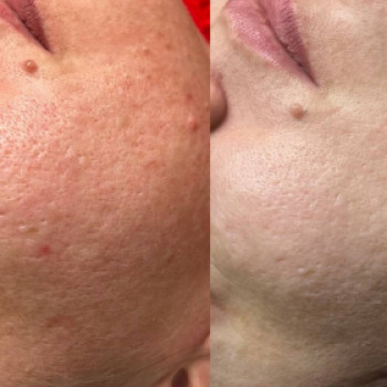 Анастасия Данилова, Владимир-Волынский Фото - 5