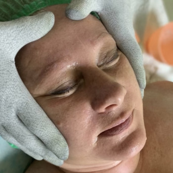 Мікротоки стимулюють вироблення колагену, еластану