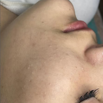 Діана Дубровська, Нововолинськ Фото - 6