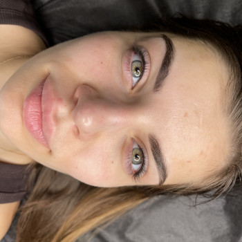 загоєні брівки та поновлена МІЖВІЙКА