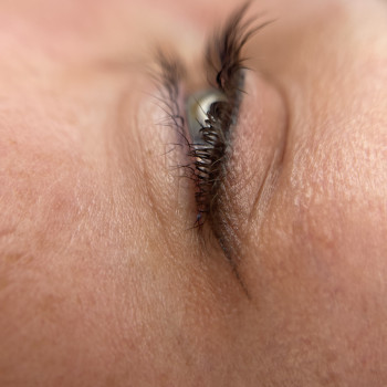 Загоєна СТРІЛОЧКА