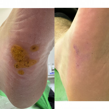 Ірина Дідківська, Буча Фото - 1