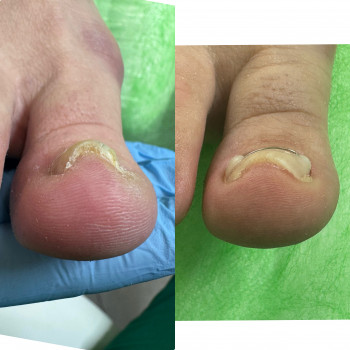 Ірина Дідківська, Буча Фото - 2