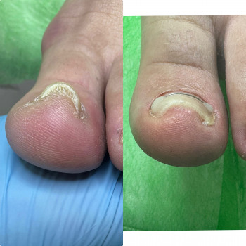 Ірина Дідківська, Буча Фото - 3