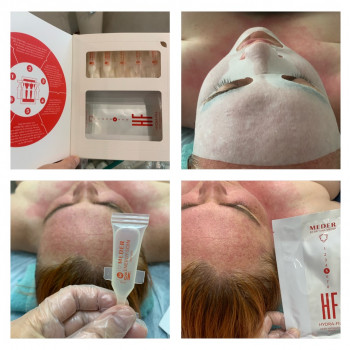 Meder Beauty Science уход по лицу “Hydro Fill”, Программа глубокого увлажнения. 
 