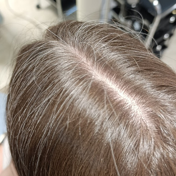 Сивина на корінні