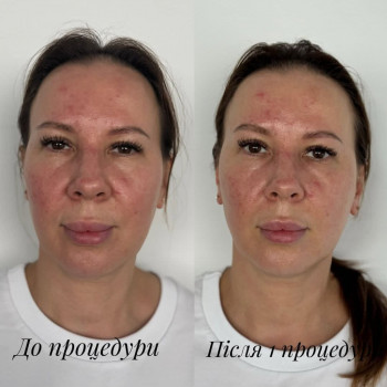 Lumine, Зміїв Фото - 5