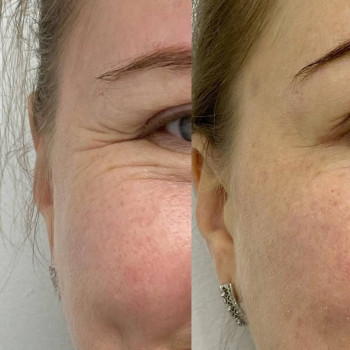 Инна Черепня, Изюм Фото - 5