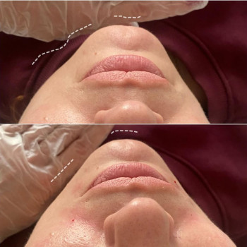 Неля Ковальцова, Ізюм Фото - 5