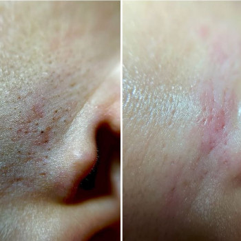 Алевтина Лещенко, Красноград Фото - 5