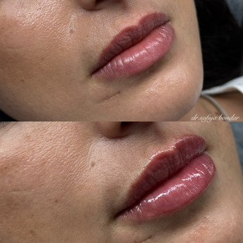 Софія Бондар, Львов Фото - 8