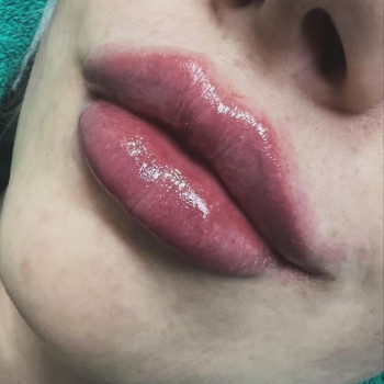 Ірина Мельник, Красноград Фото - 5