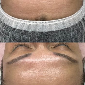 Процедура Матрикс Актив. Наповнює шкіру вологою, розгладжує зморшки, освітлює, вирівнює рельєф шкіри...