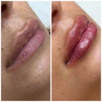 Kissed lips