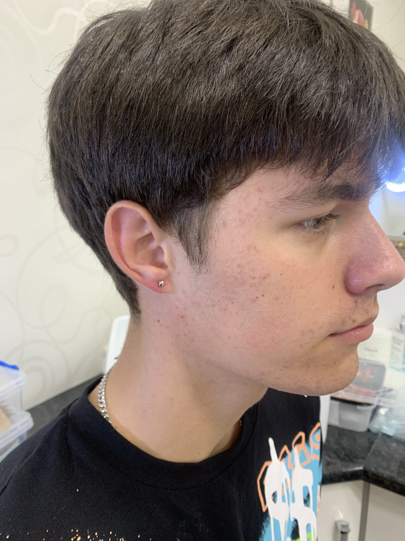 Прокол мочки вуха чоловіку, фото - Майстер з пірсингу Тетяна Ананьєва