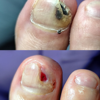 Центр подологии и тейпирования, Запорожье Фото - 25