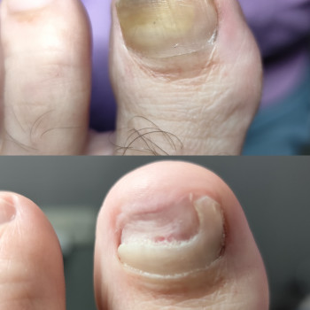 Центр подологии и тейпирования, Запорожье Фото - 6