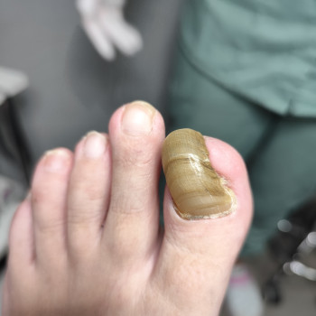 Центр подологии и тейпирования, Запорожье Фото - 7