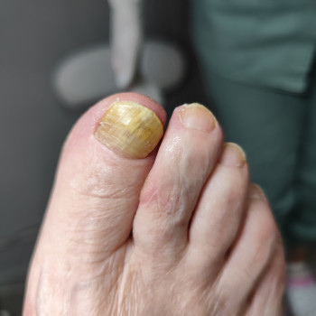 Центр подологии и тейпирования, Запорожье Фото - 9