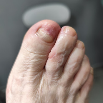 Центр подологии и тейпирования, Запорожье Фото - 10