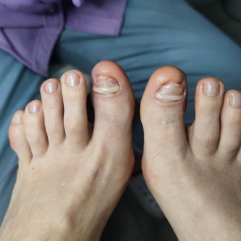 Центр подологии и тейпирования, Запорожье Фото - 11