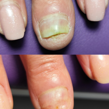 Центр подологии и тейпирования, Запорожье Фото - 13