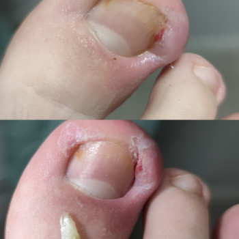 Центр подологии и тейпирования, Запорожье Фото - 15