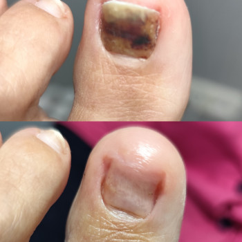 Центр подологии и тейпирования, Запорожье Фото - 16