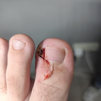 Центр подологии и тейпирования, Запорожье Фото - 18