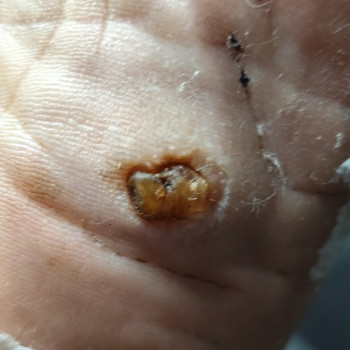 Центр подологии и тейпирования, Запорожье Фото - 19