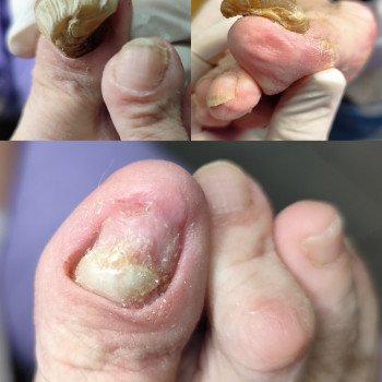 Центр подологии и тейпирования, Запорожье Фото - 22