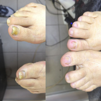 Фото з портфоліо фахівця Ольга Немченко (подолог, Київ)