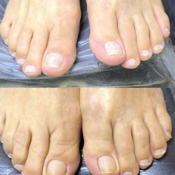 Фото з портфоліо фахівця Ольга Немченко (подолог, Київ)