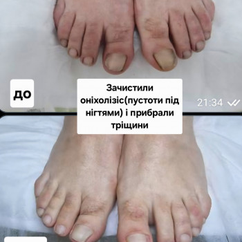 Фото з портфоліо фахівця Ольга Немченко (подолог, Київ)