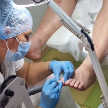 Фото з портфоліо фахівця Ольга Немченко (подолог, Київ)